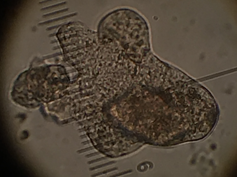 Bulbous amoeba2.png